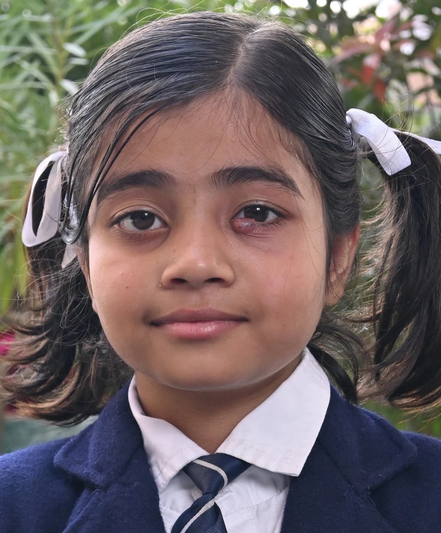 ILMA  IRFAN